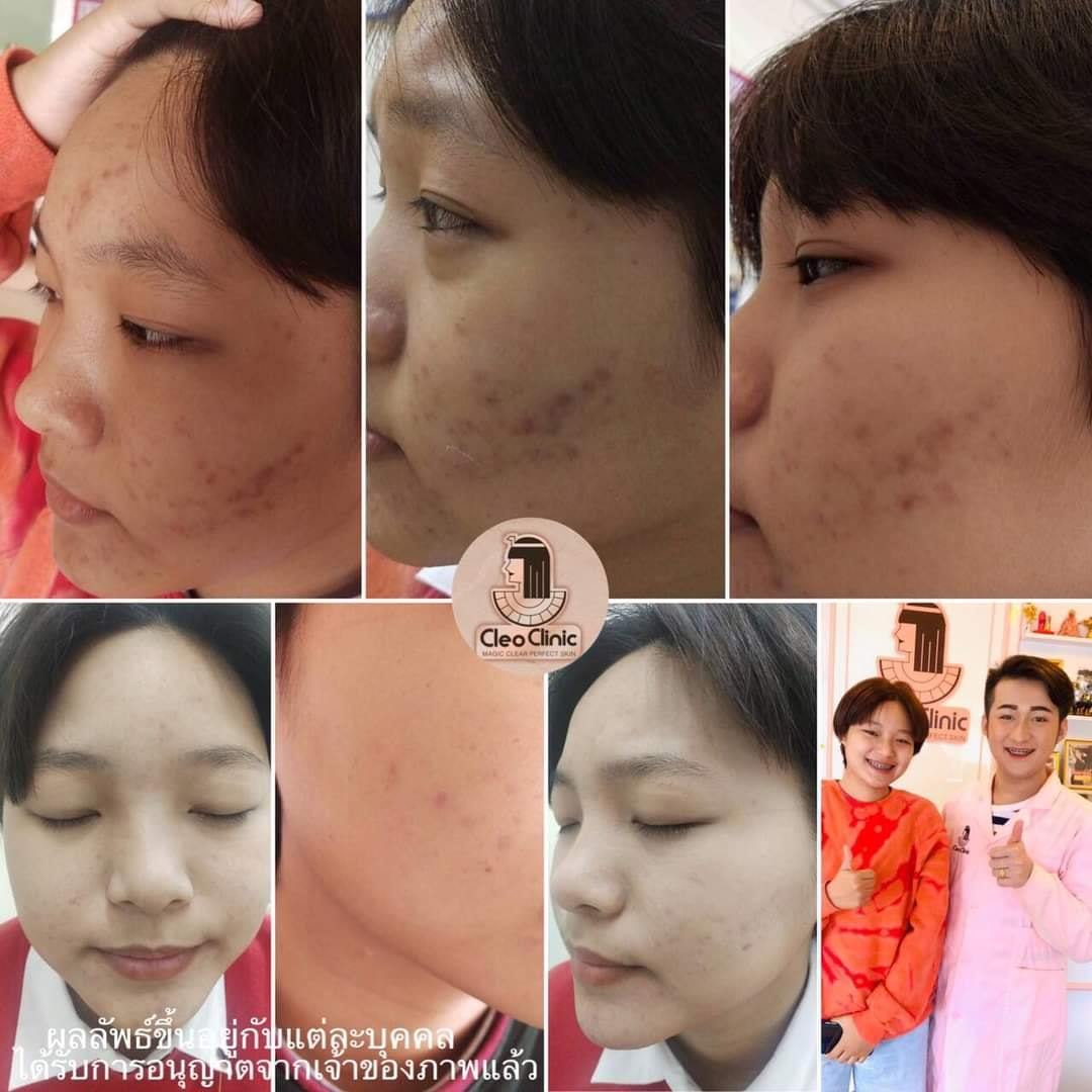 รีวิว ปี 62