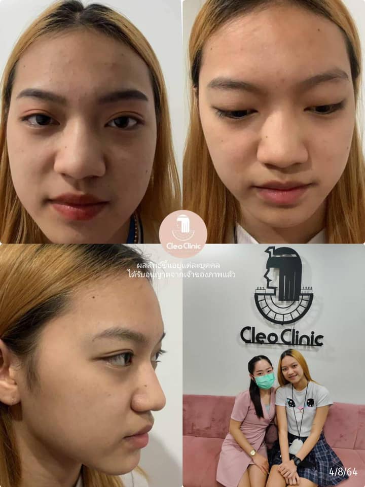 รีวิว ปี 62