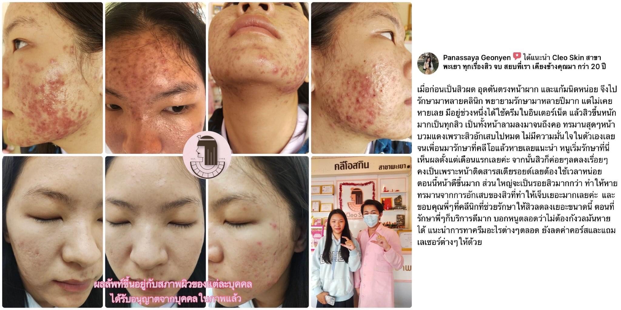 รีวิว ปี 62