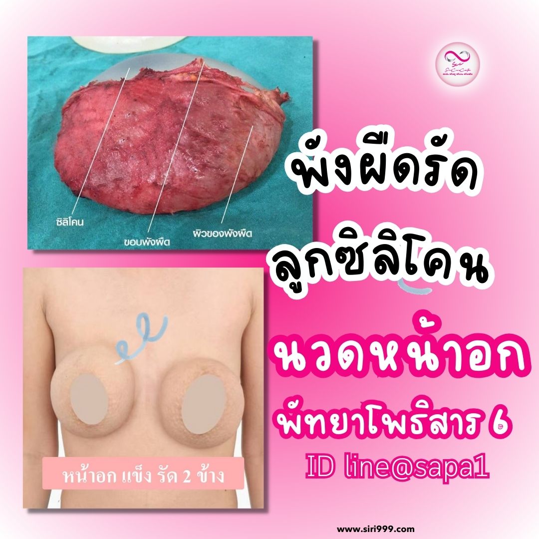 นวดหน้าอกพัทยาโพธิสาร6