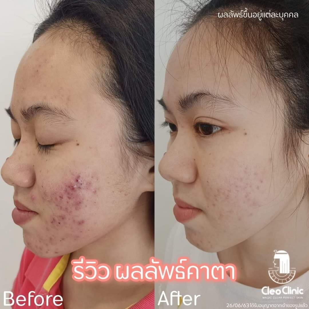 รีวิว ปี 62