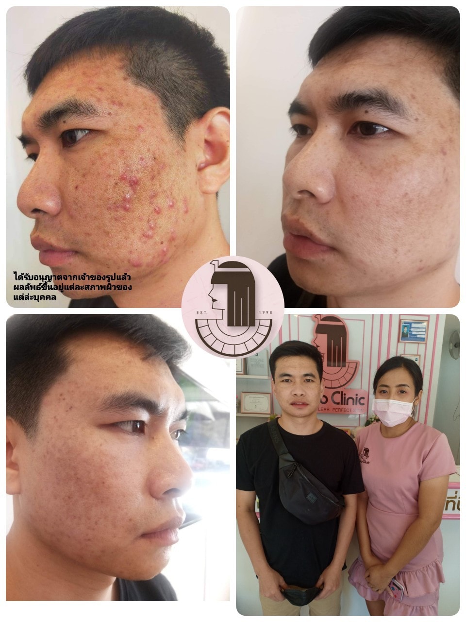 รีวิว ปี 62