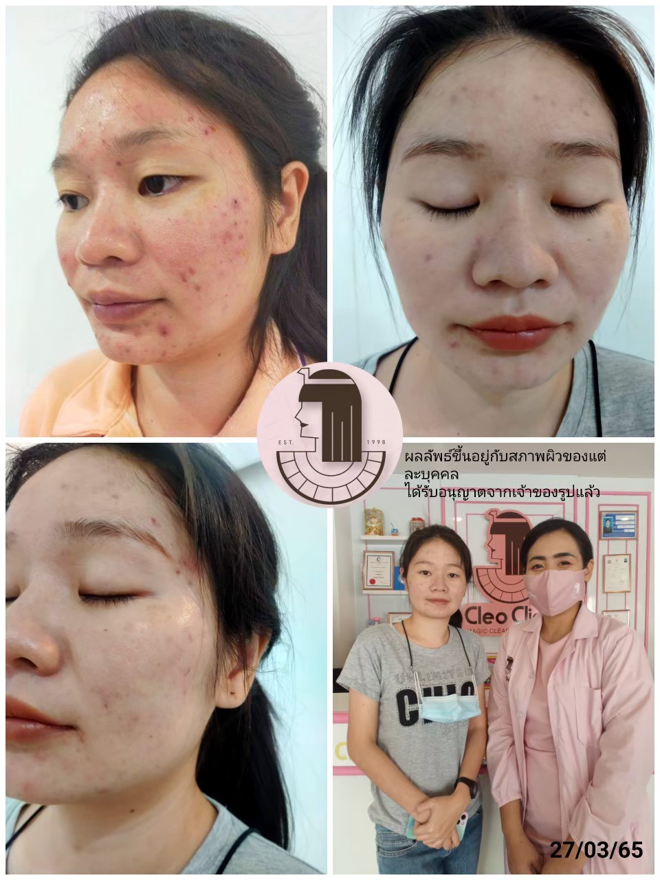 รีวิว ปี 62