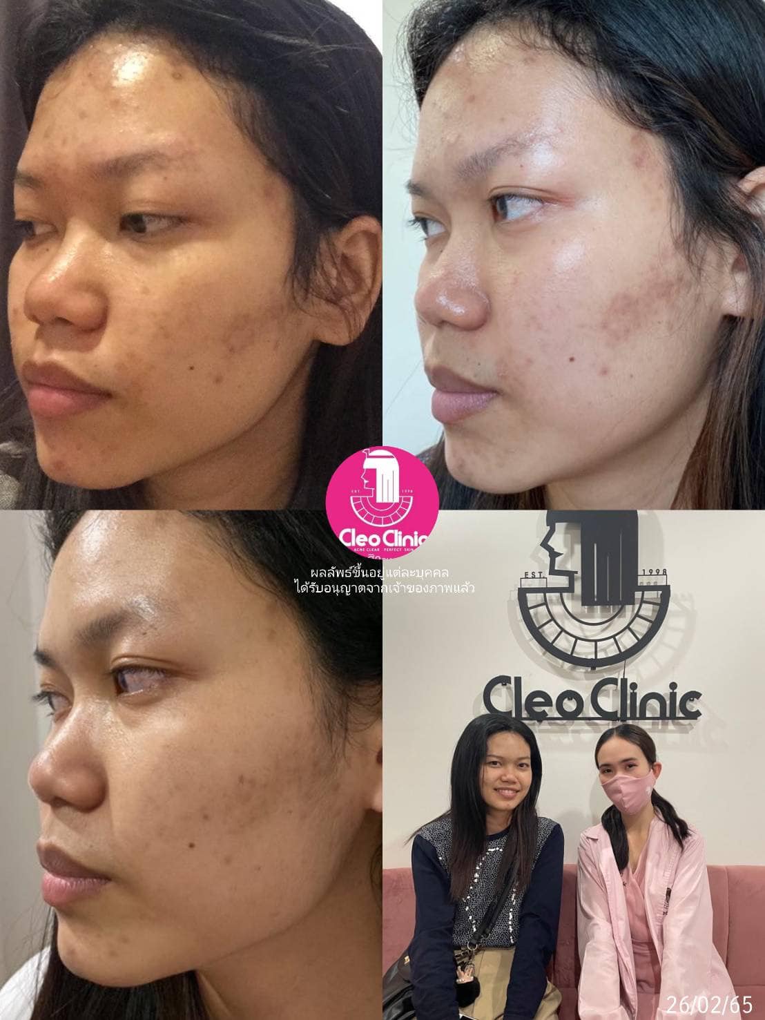 รีวิว ปี 62