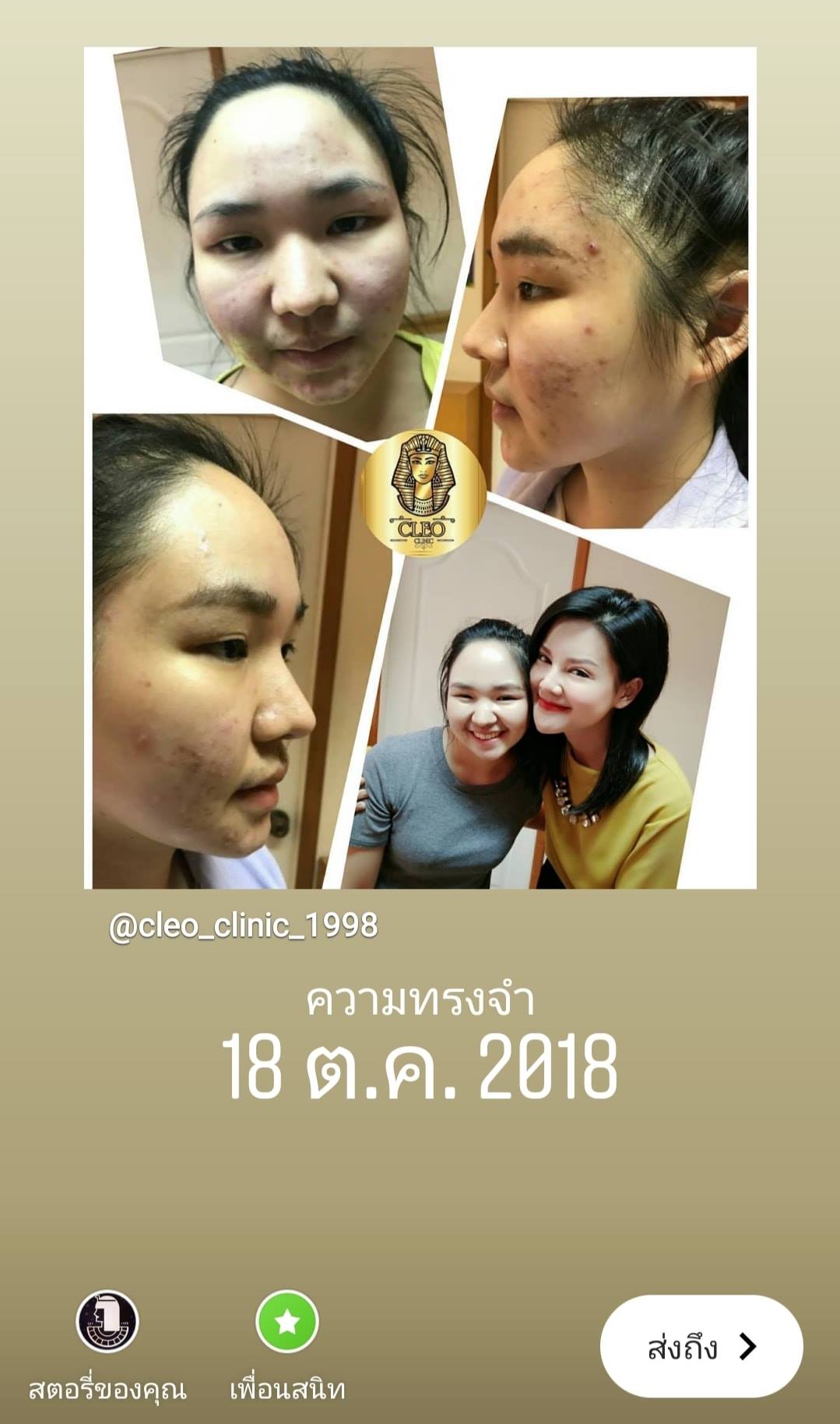 รีวิว ปี 62