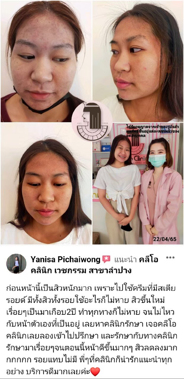 รีวิว ปี 62