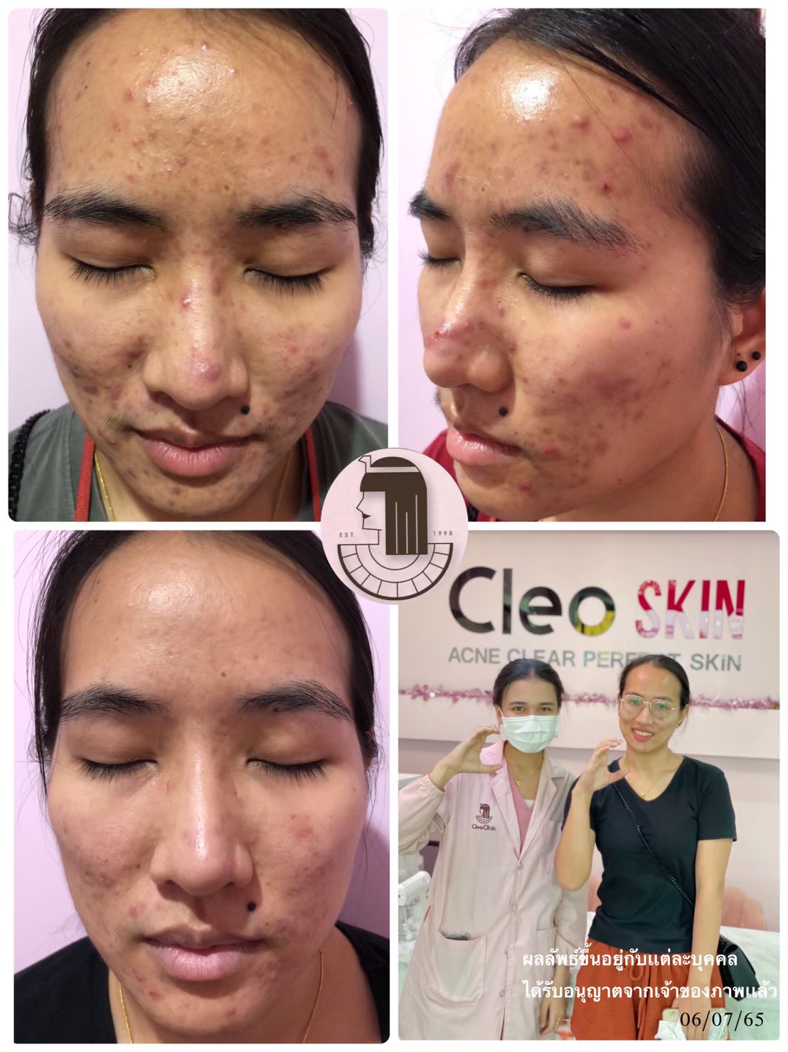 รีวิว ปี 62