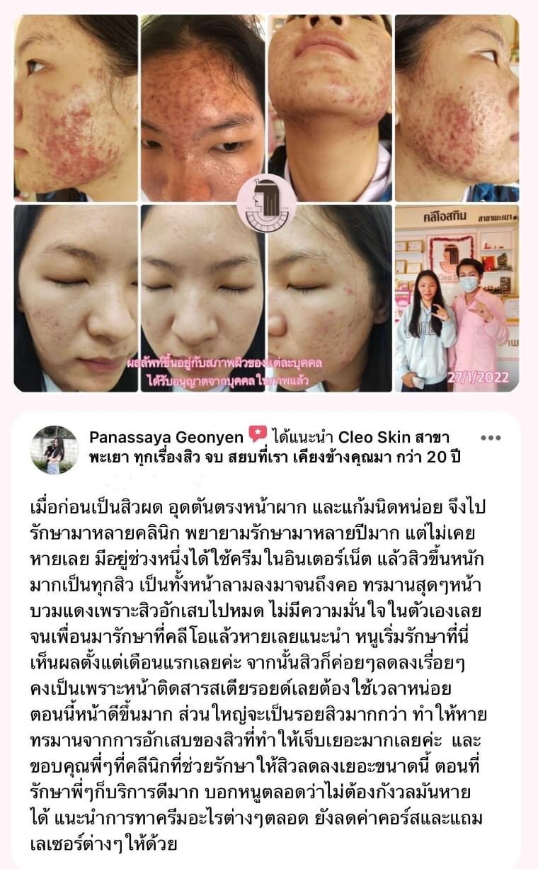 รีวิว ปี 62