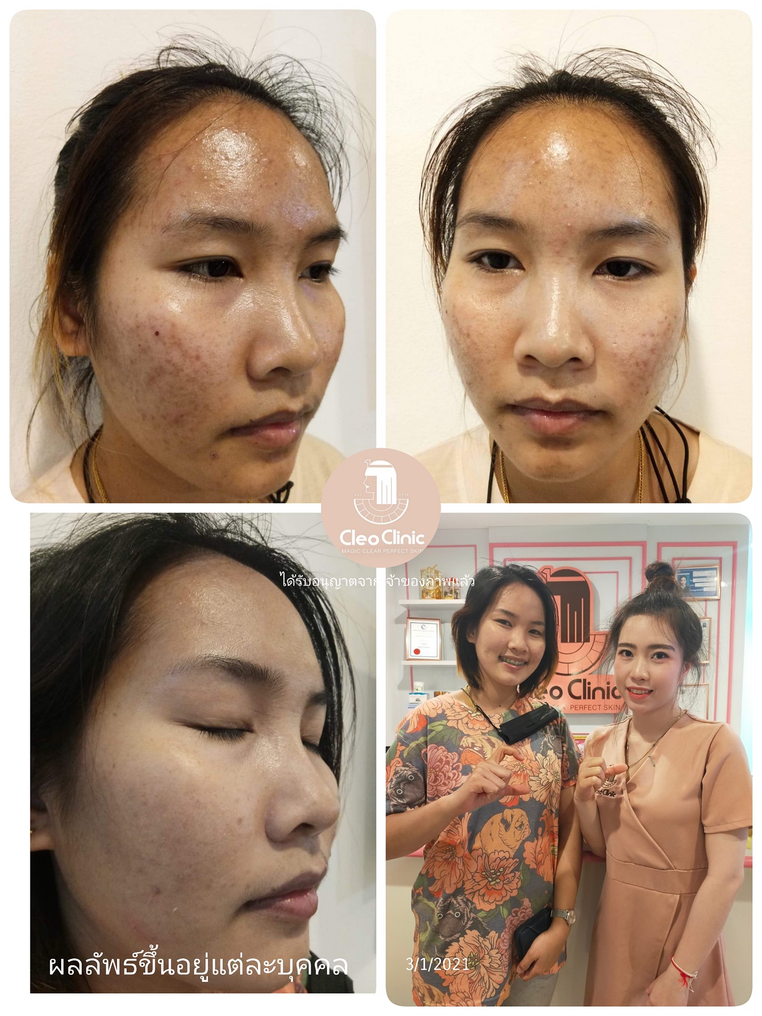 รีวิว ปี 62