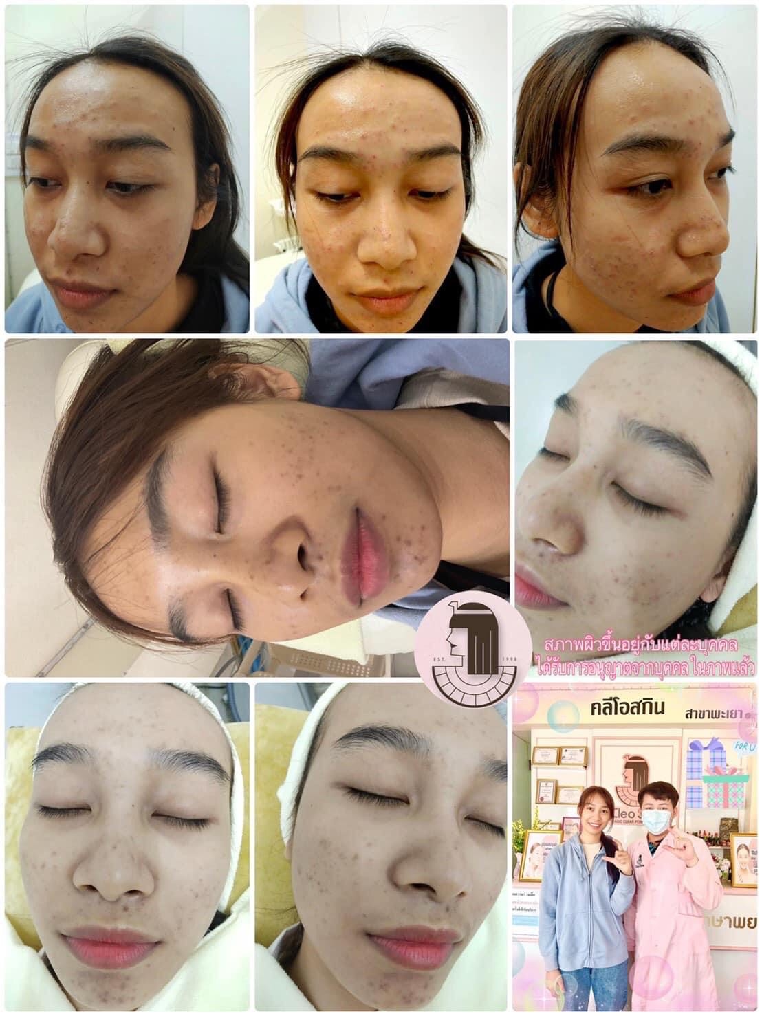 รีวิว ปี 62