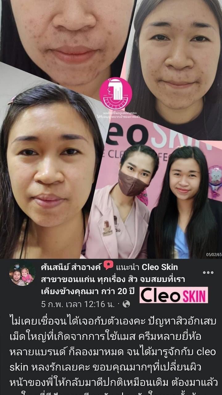 รีวิว ปี 62