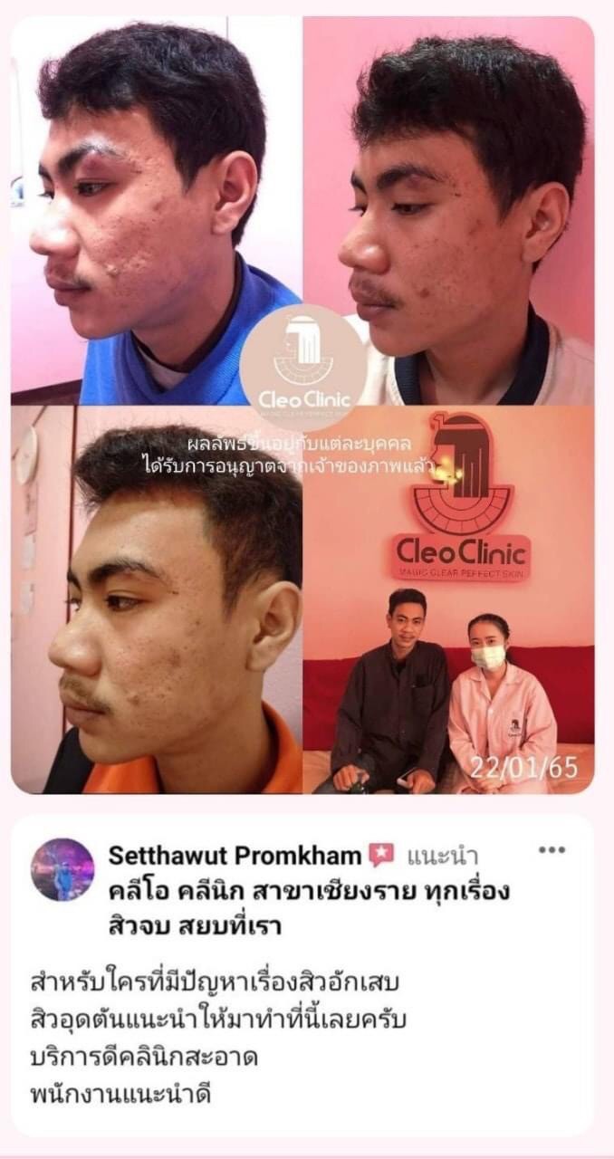 รีวิว ปี 62