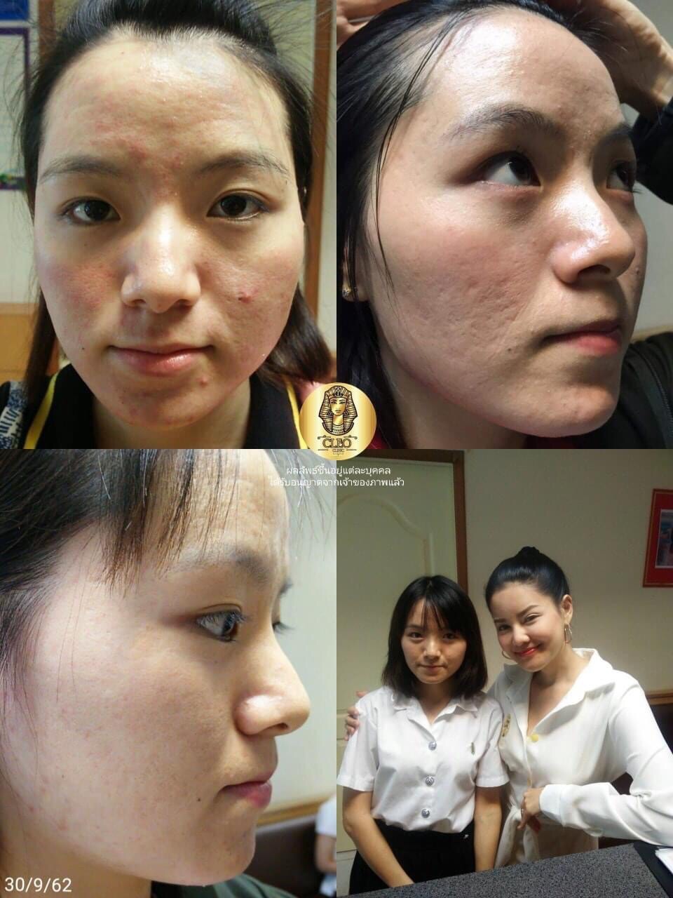 รีวิว ปี 62