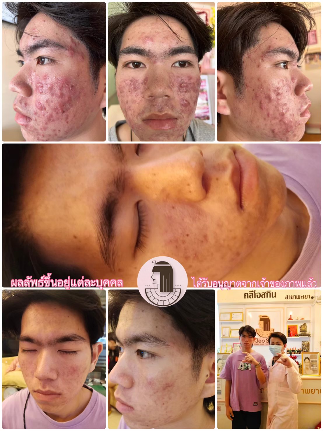 รีวิว ปี 62