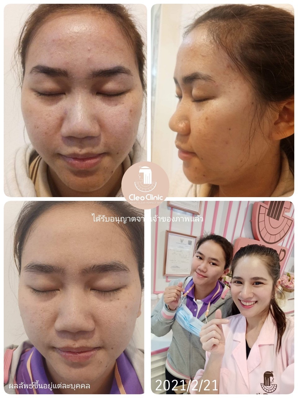 รีวิว ปี 62