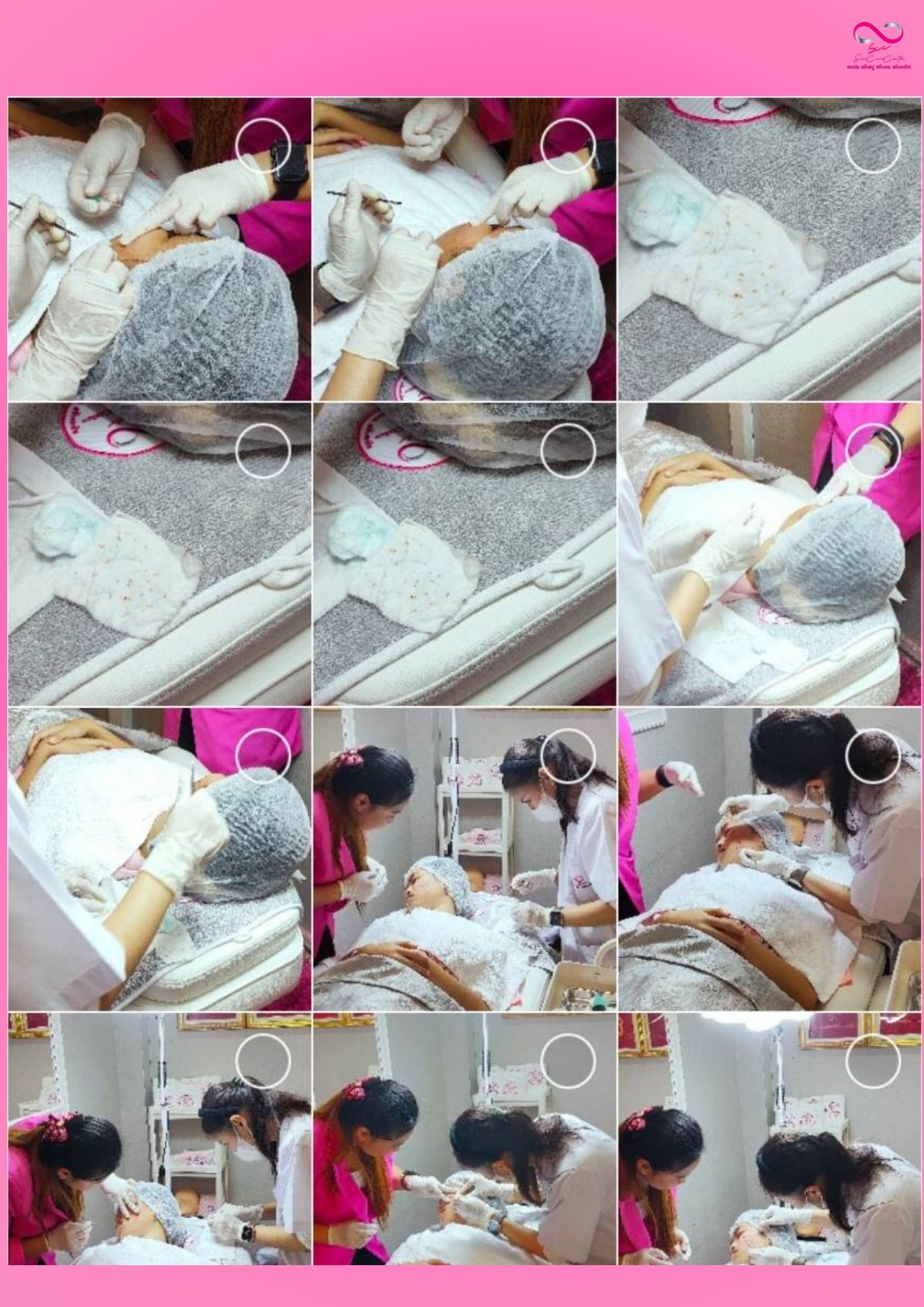 เรียนกดสิว หลักสูตรวิทยากรครูสอนกดสิว