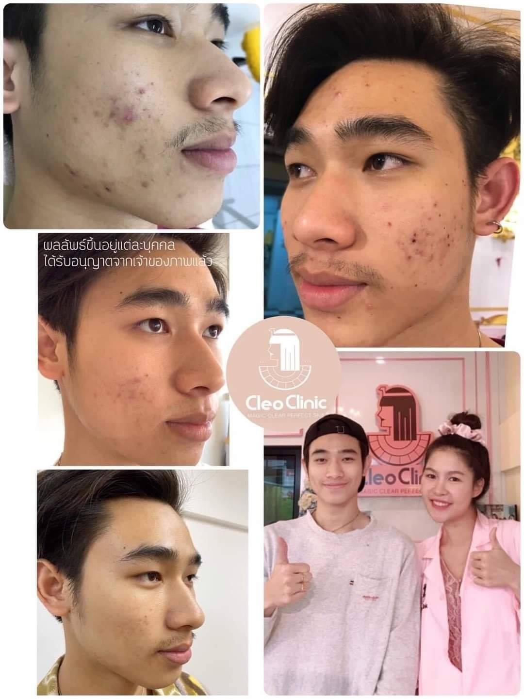 รีวิว ปี 62