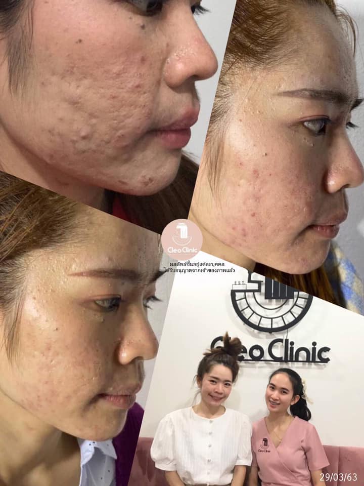 รีวิว ปี 62