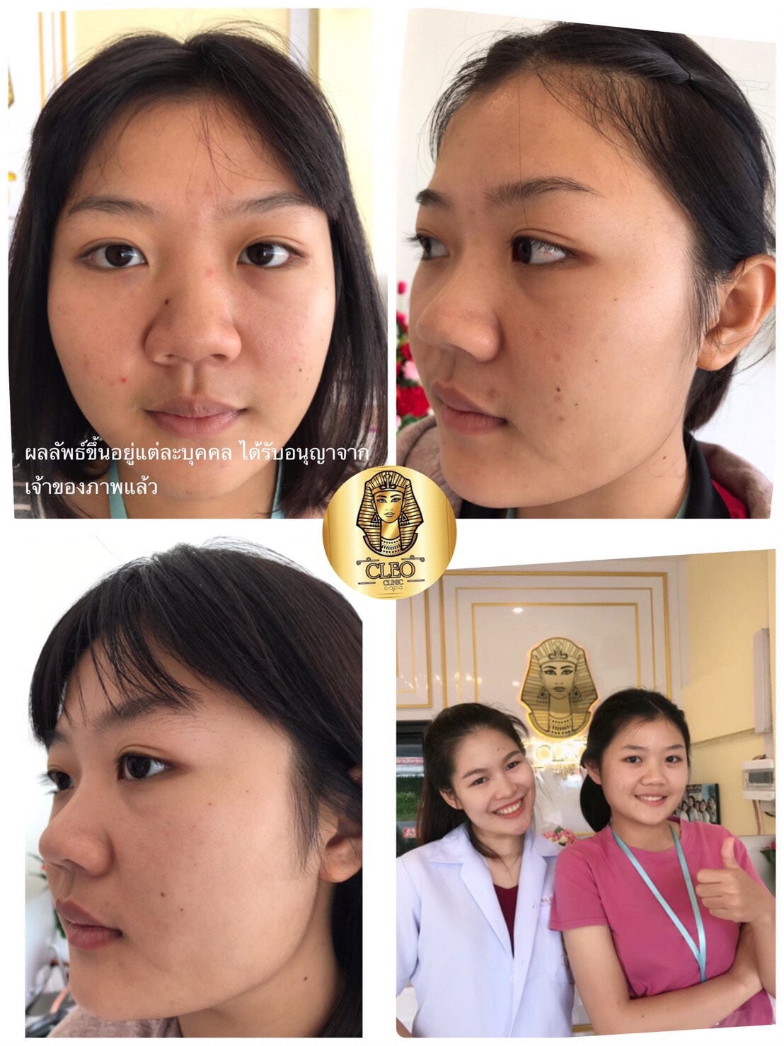 รีวิว ปี 62