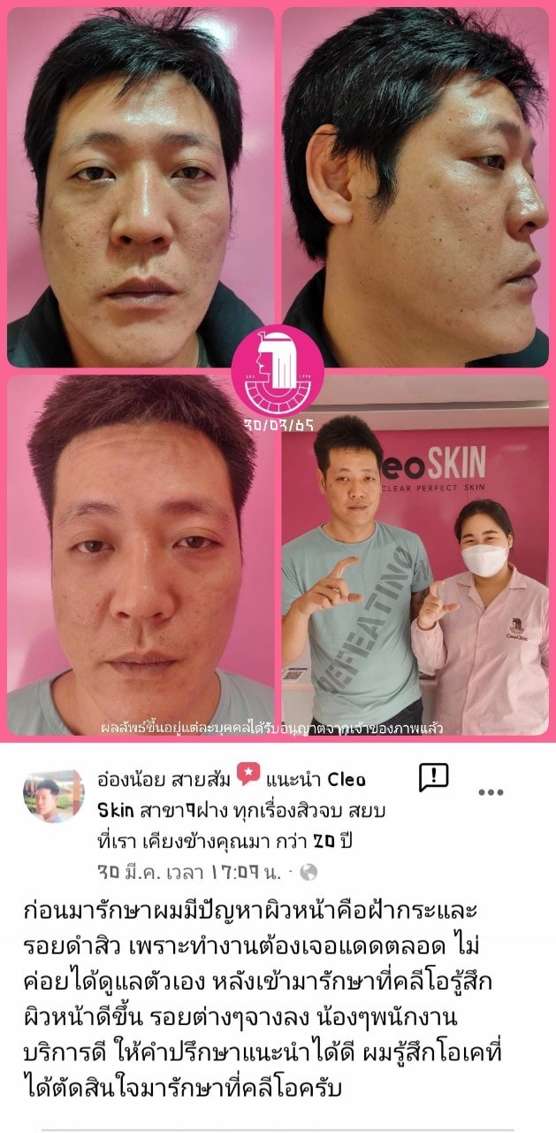 รีวิว ปี 62