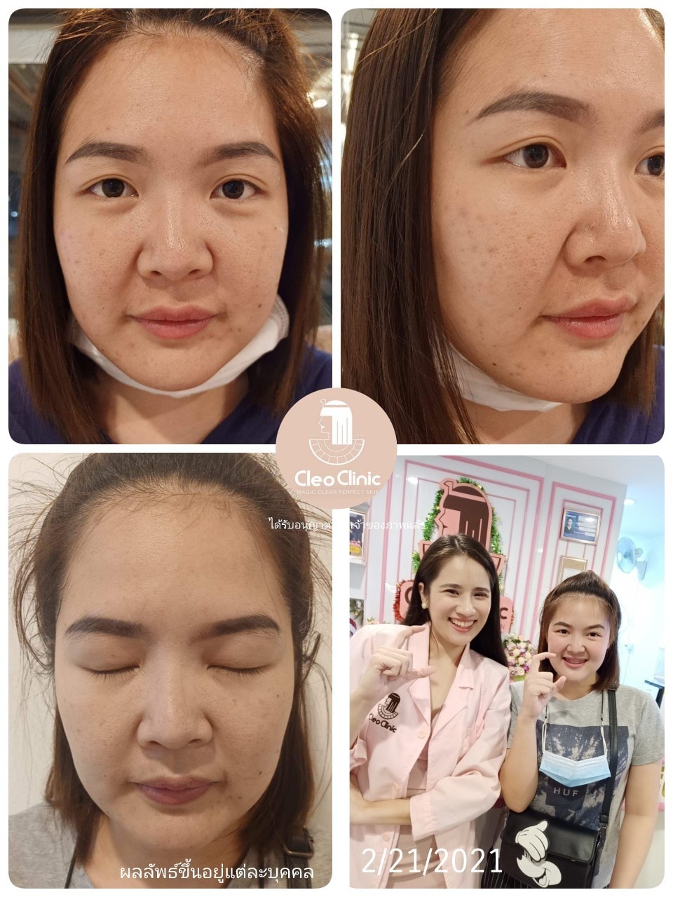 รีวิว ปี 62