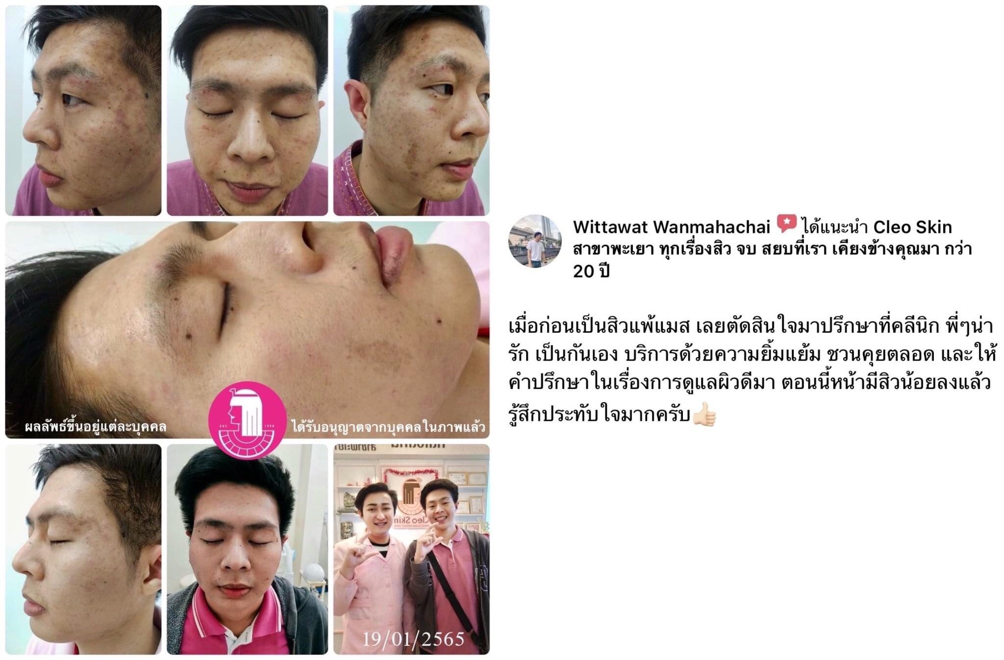 รีวิว ปี 62