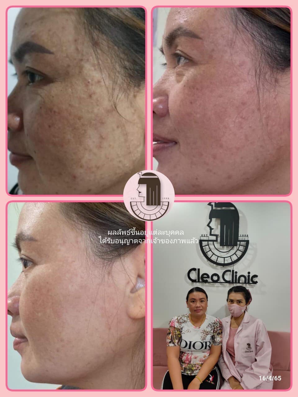 รีวิว ปี 62