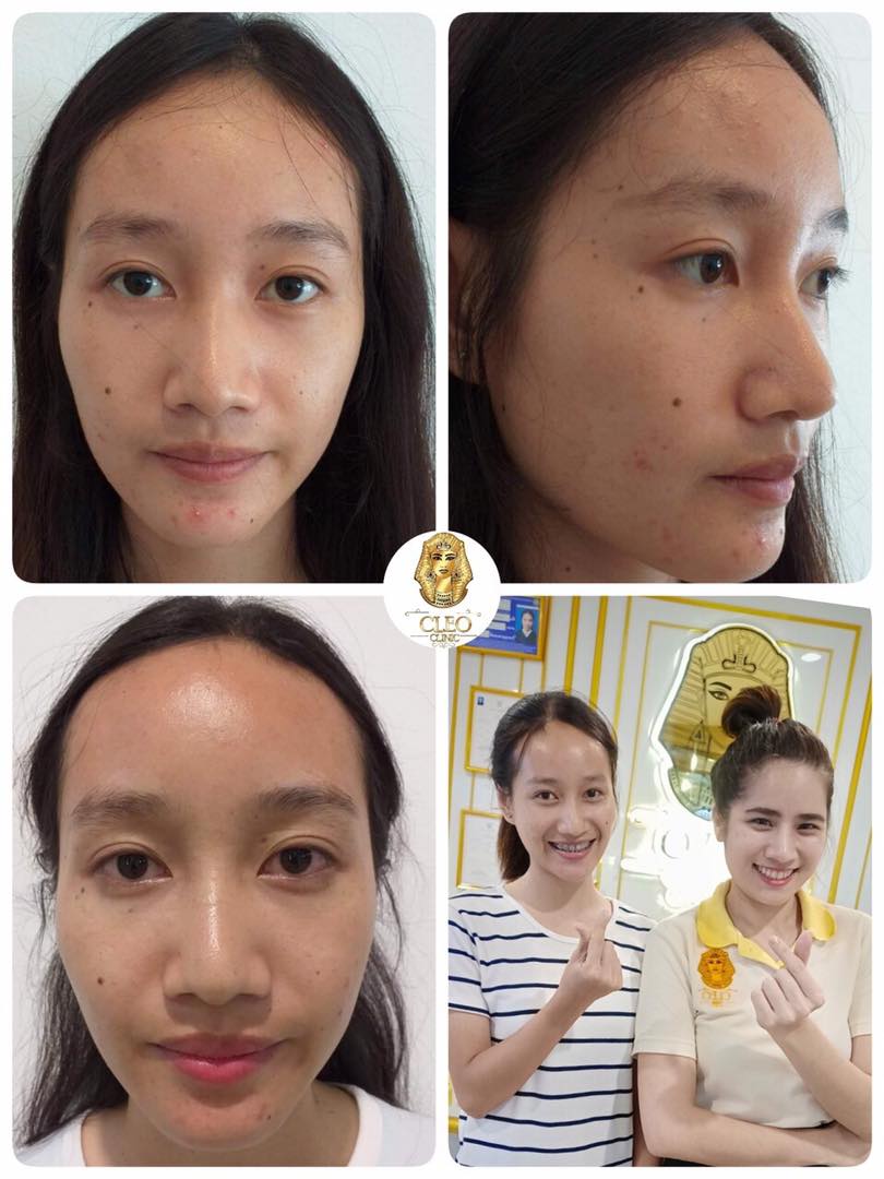 รีวิว ปี 62