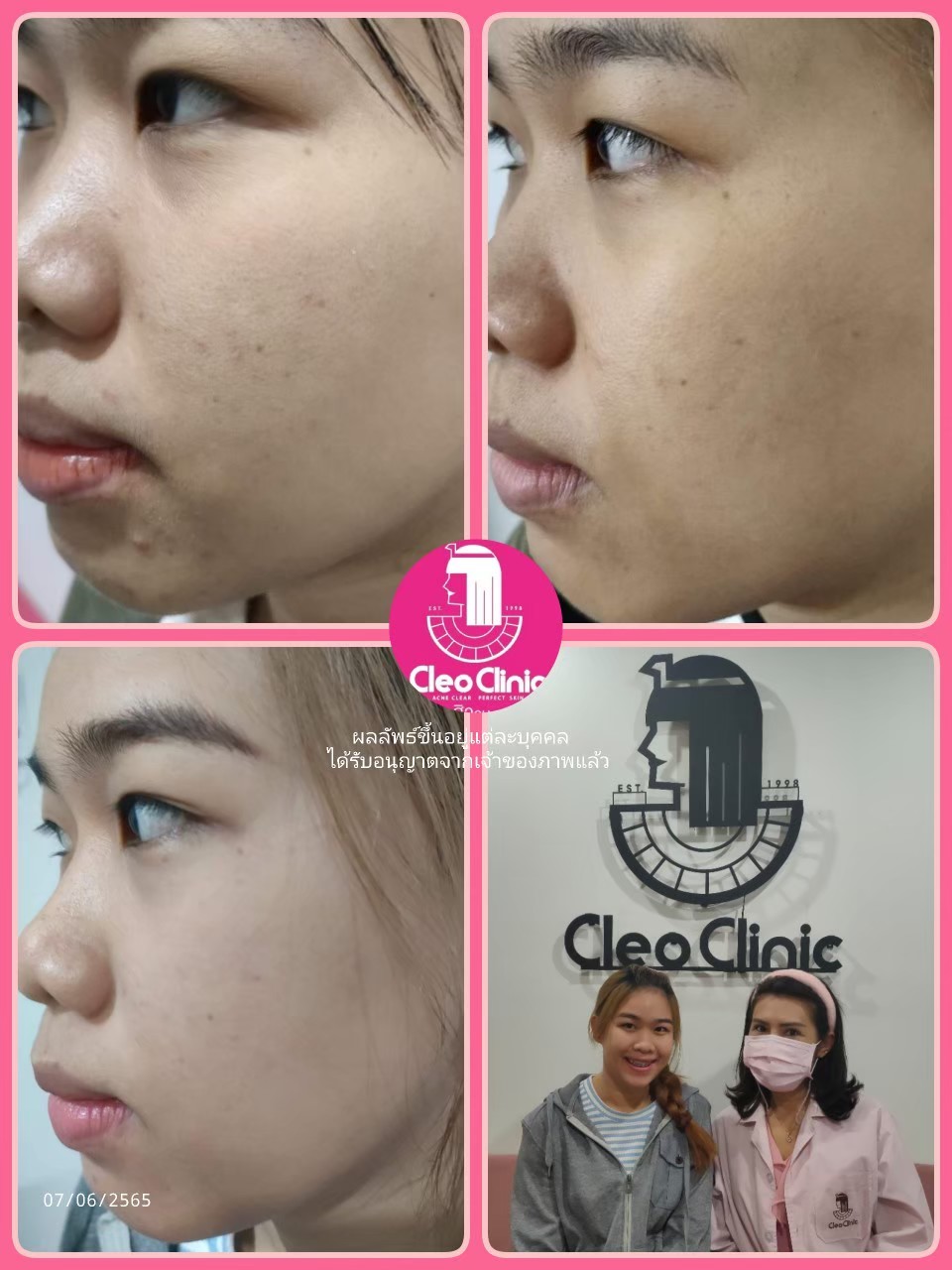 รีวิว ปี 62