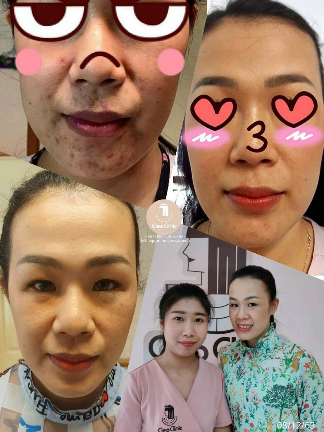 รีวิว ปี 62