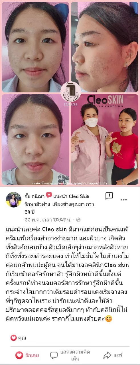 รีวิว ปี 62