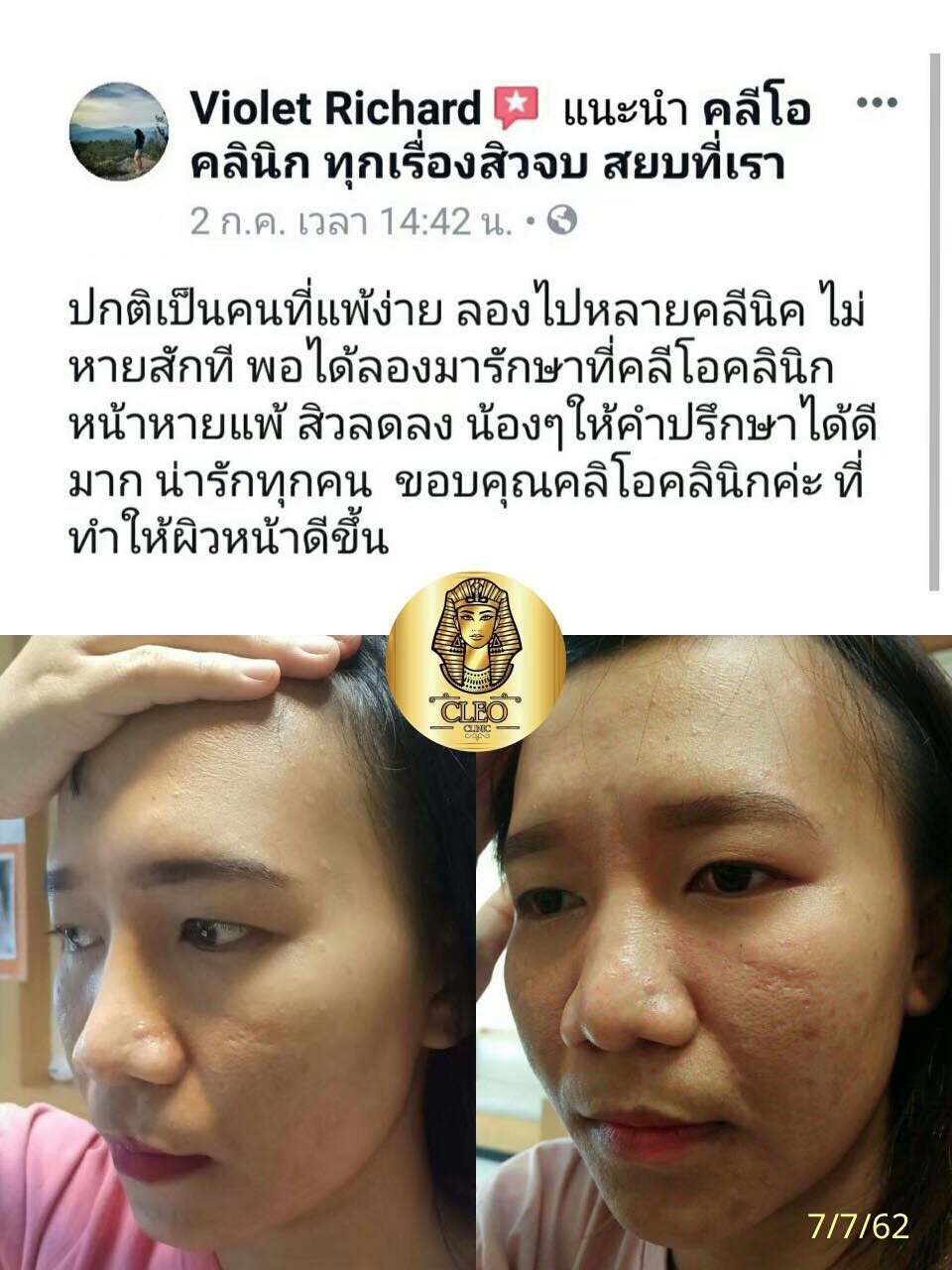 รีวิว ปี 62