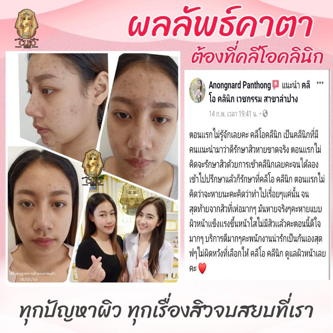 รีวิว ปี 62