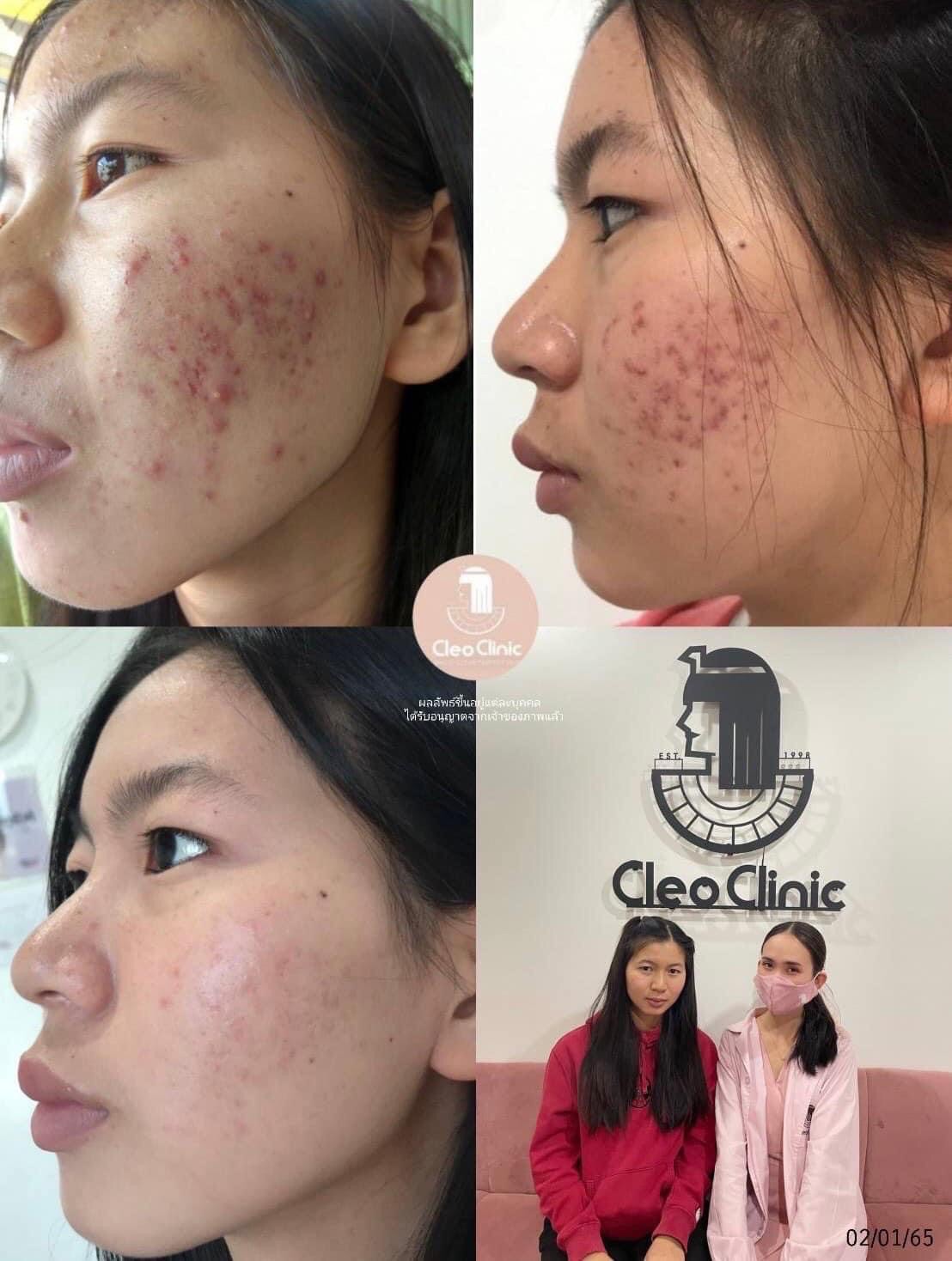 รีวิว ปี 62