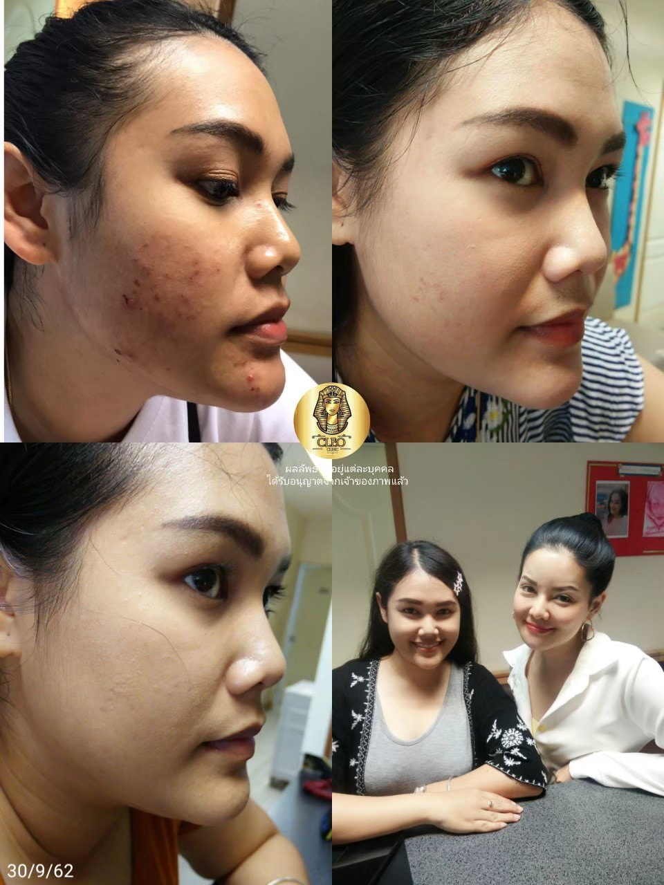 รีวิว ปี 62