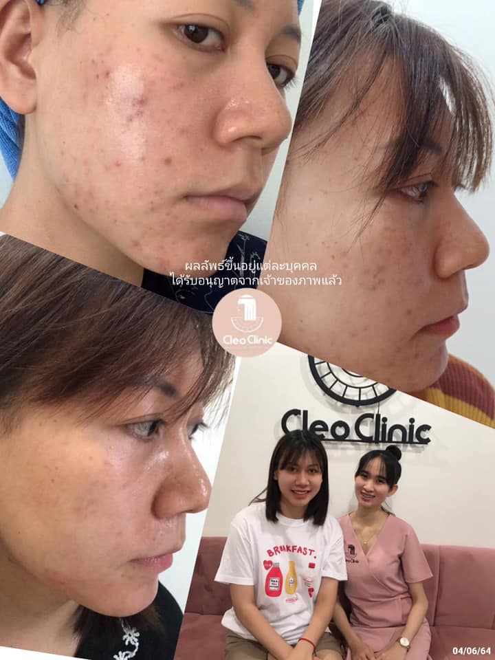 รีวิว ปี 62