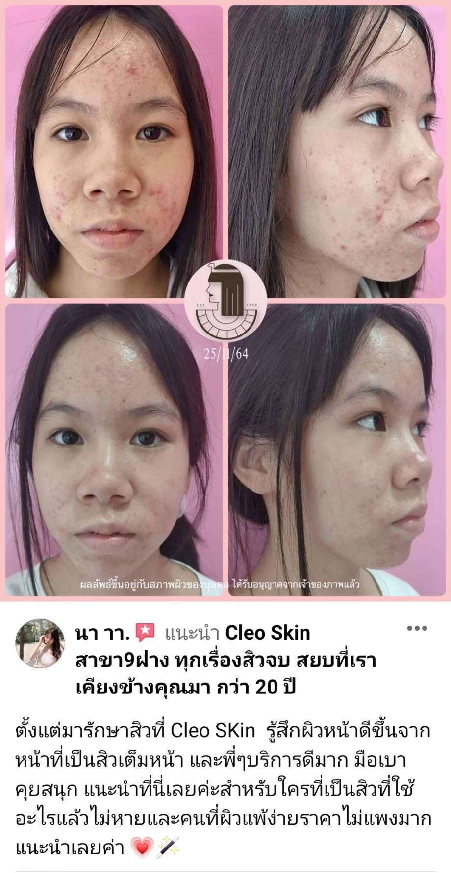 รีวิว ปี 62