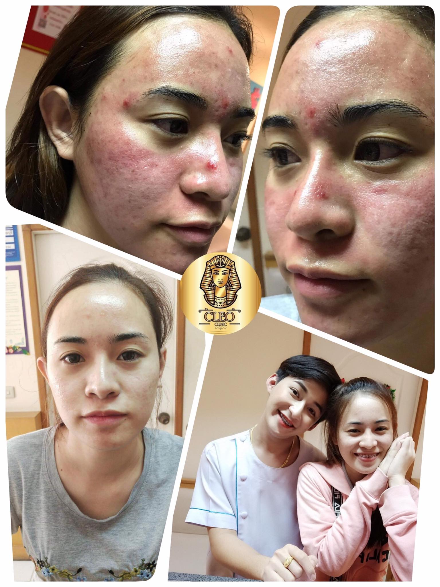 รีวิว ปี 62