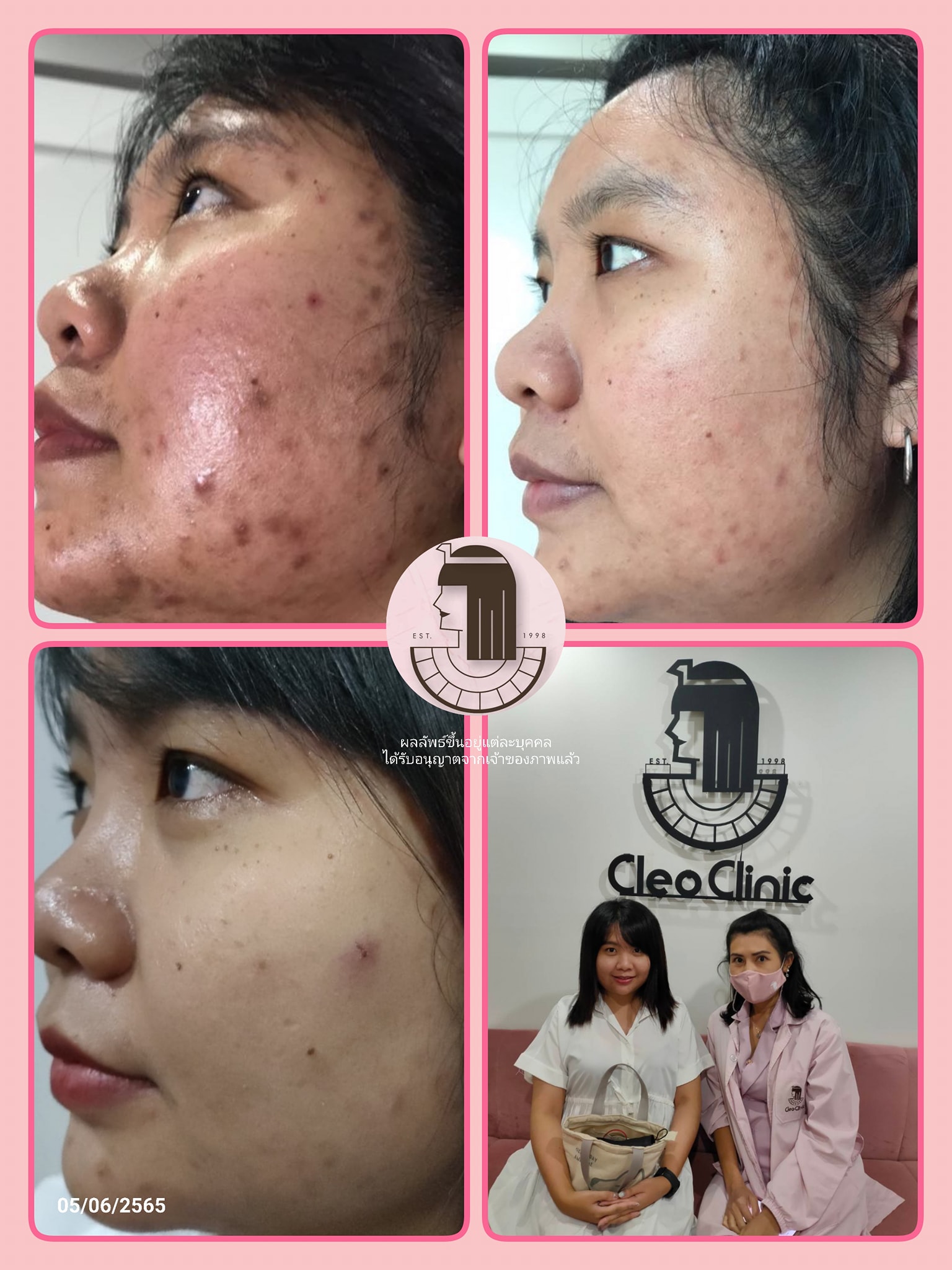 รีวิว ปี 62