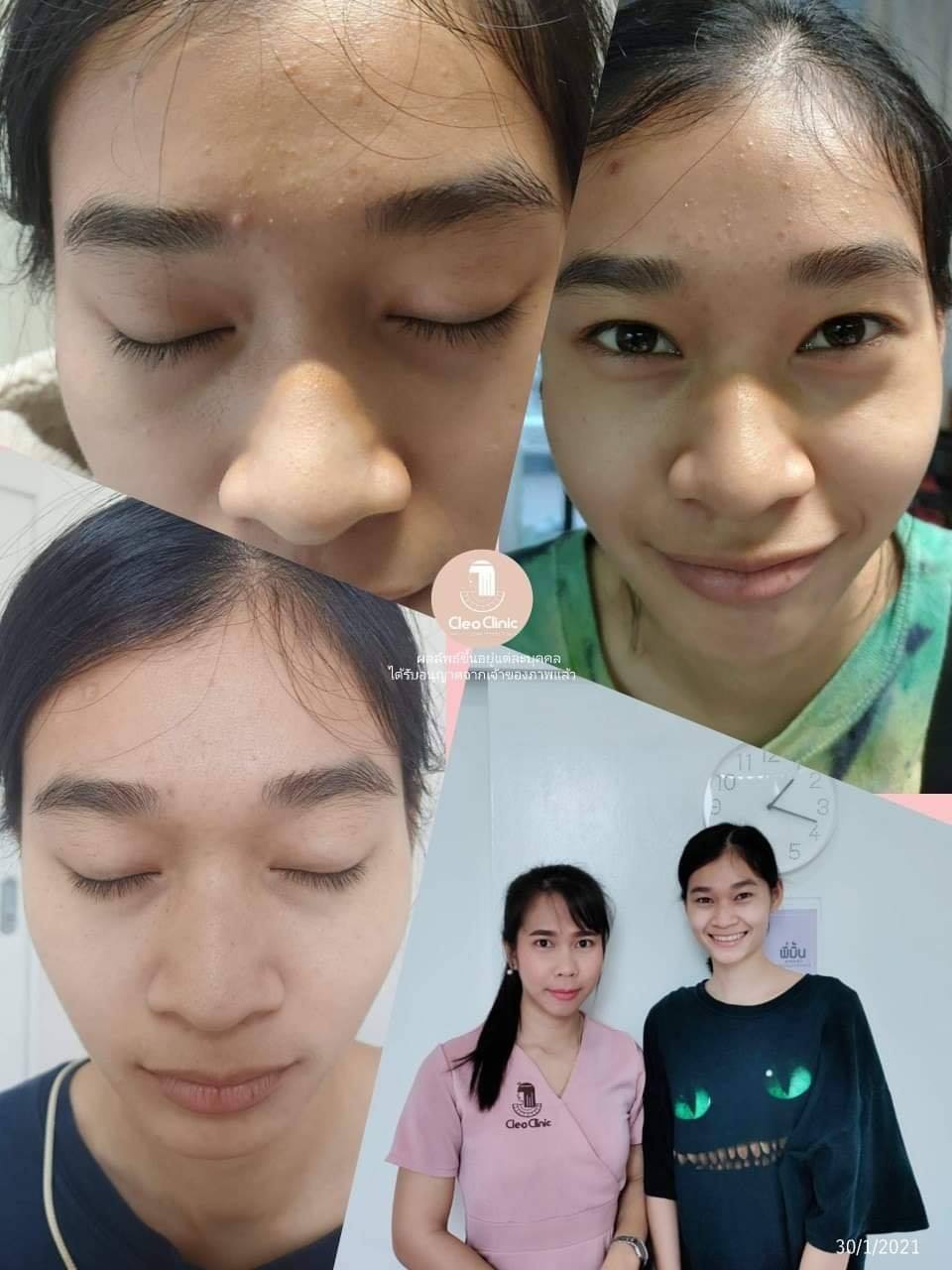 รีวิว ปี 62