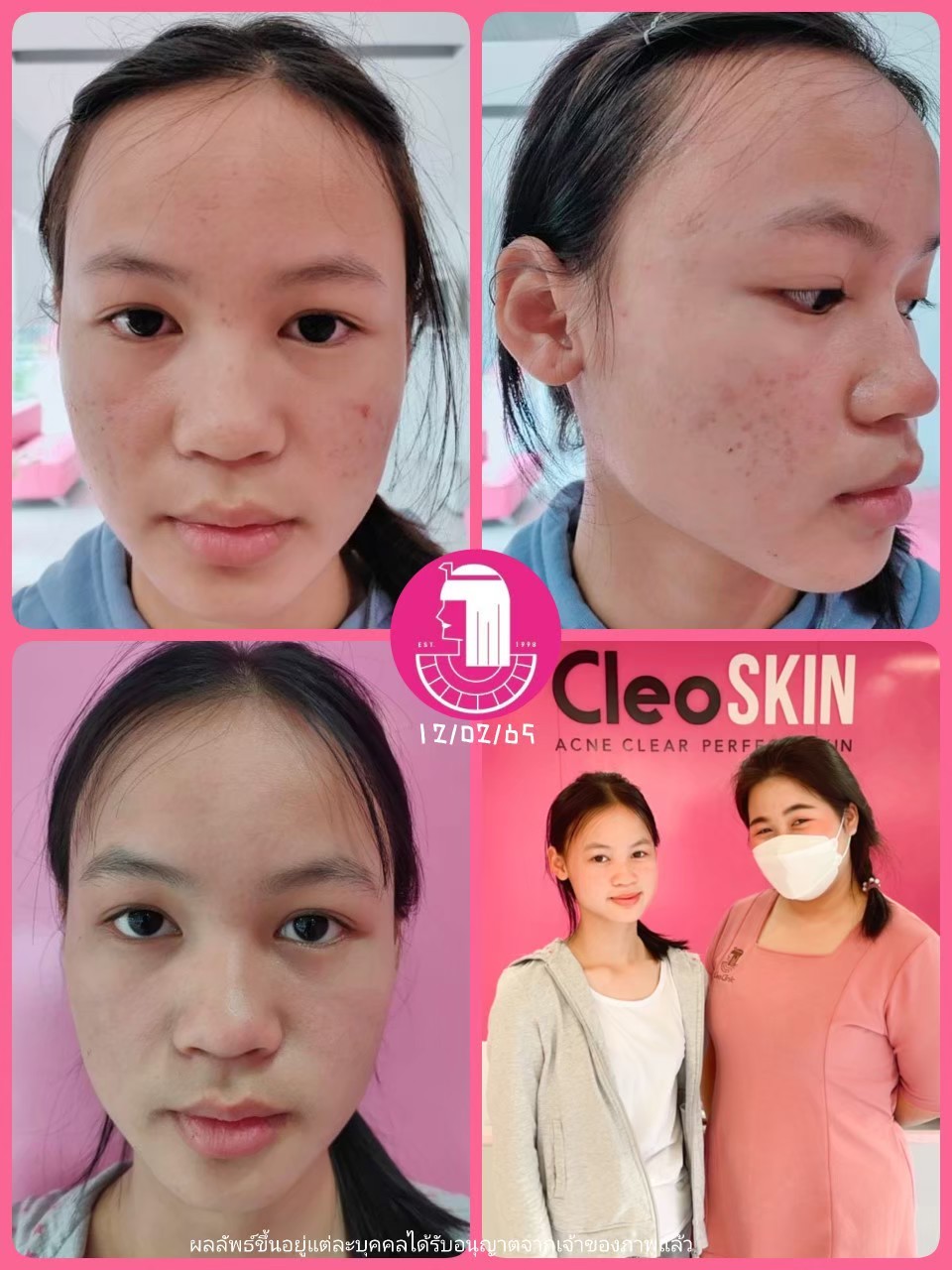 รีวิว ปี 62