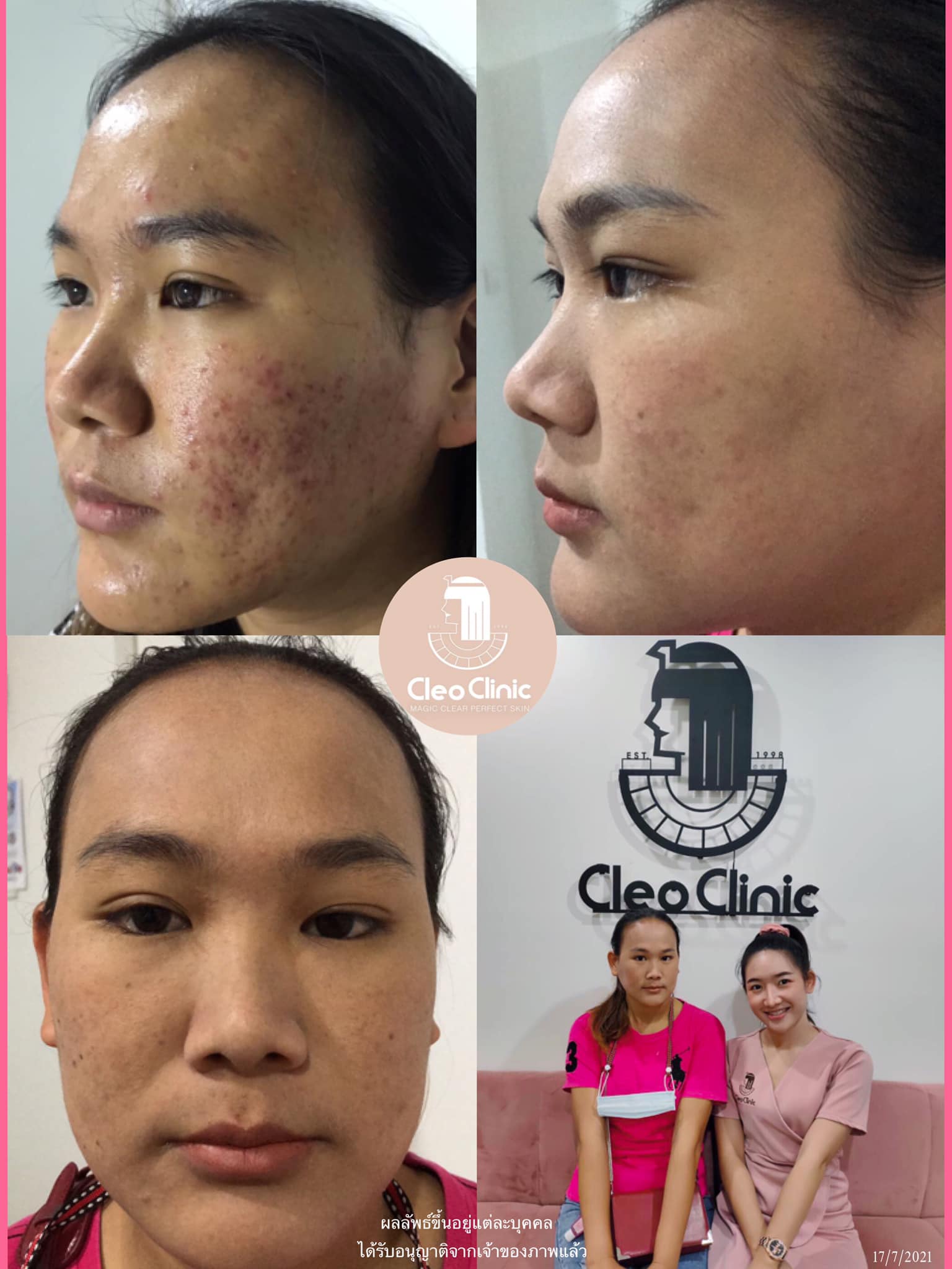 รีวิว ปี 62