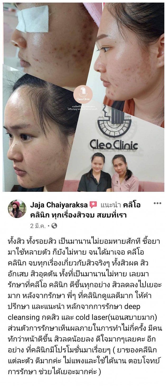 รีวิว ปี 62