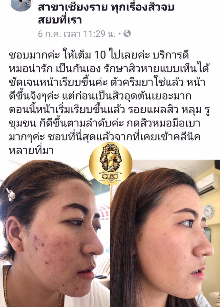 รีวิว ปี 62