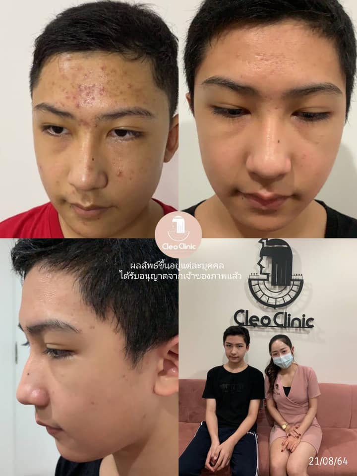 รีวิว ปี 62