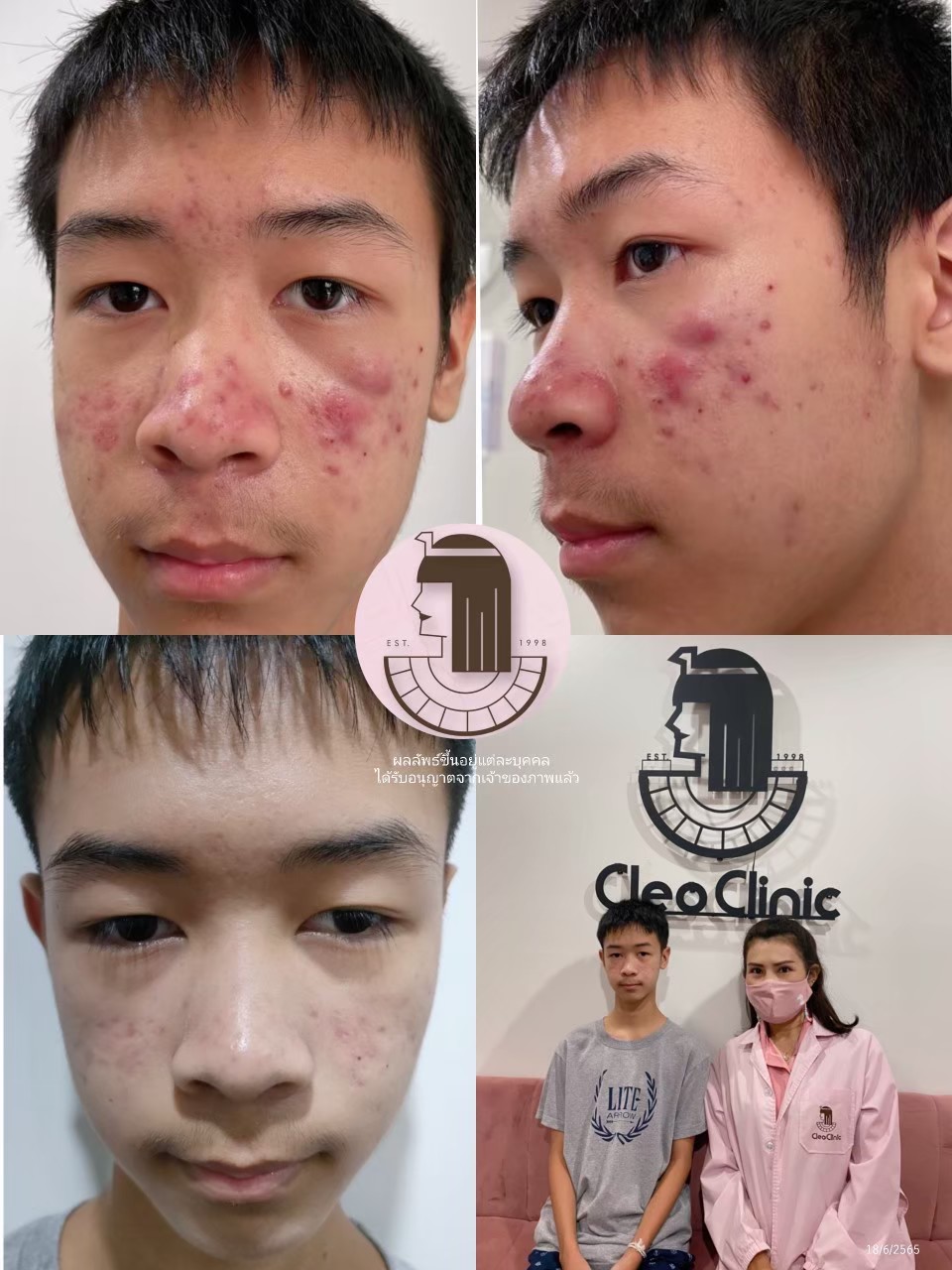 รีวิว ปี 62