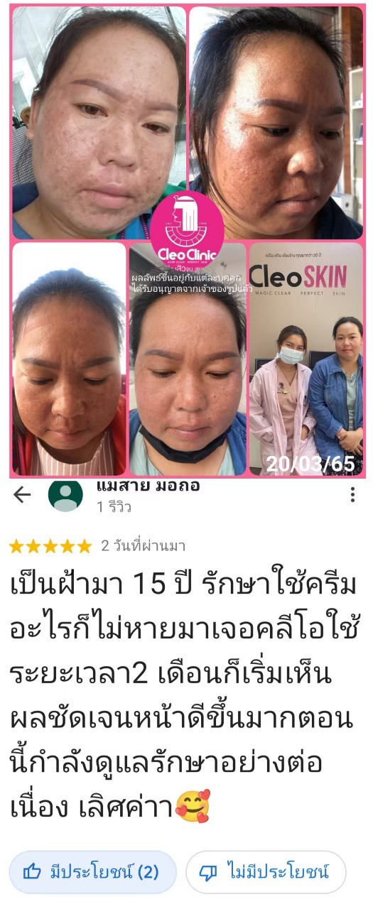 รีวิว ปี 62