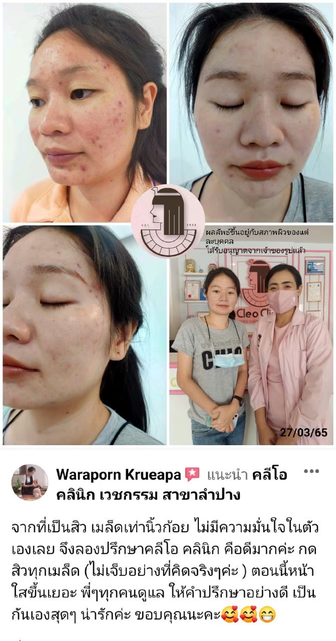 รีวิว ปี 62