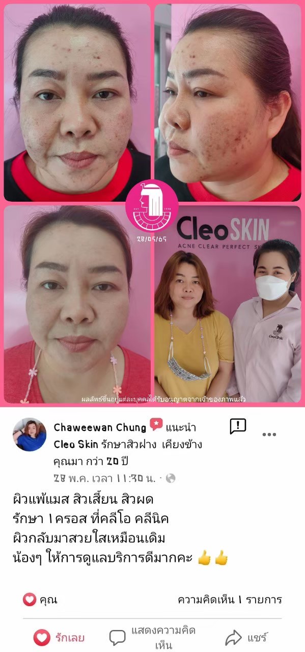 รีวิว ปี 62