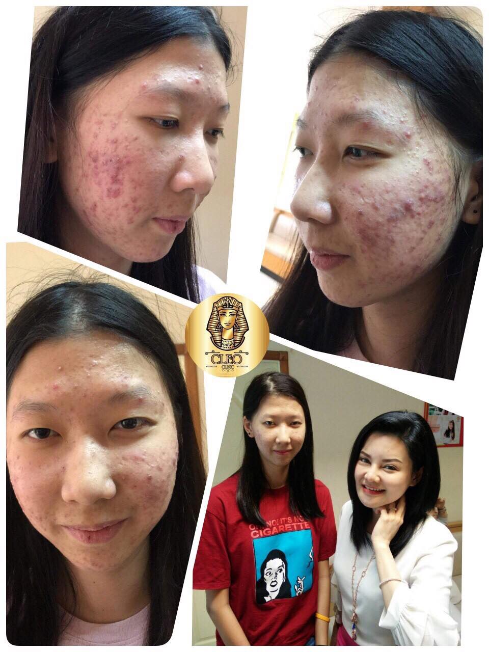 รีวิว ปี 62